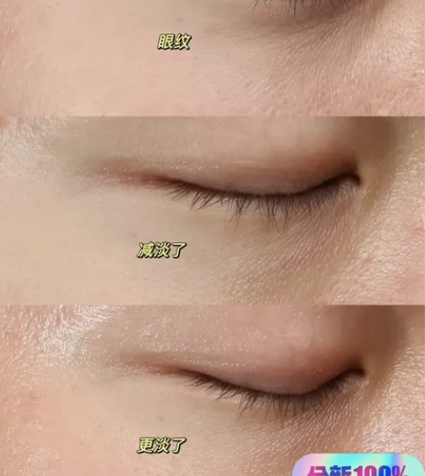 眼霜去黑眼圈去眼袋去细纹紧致抗皱熬夜神器√...