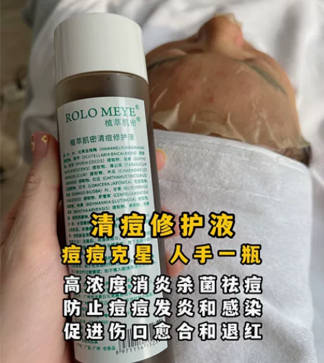 睿路美业 清痘修复液,全新未拆封 正品,有...