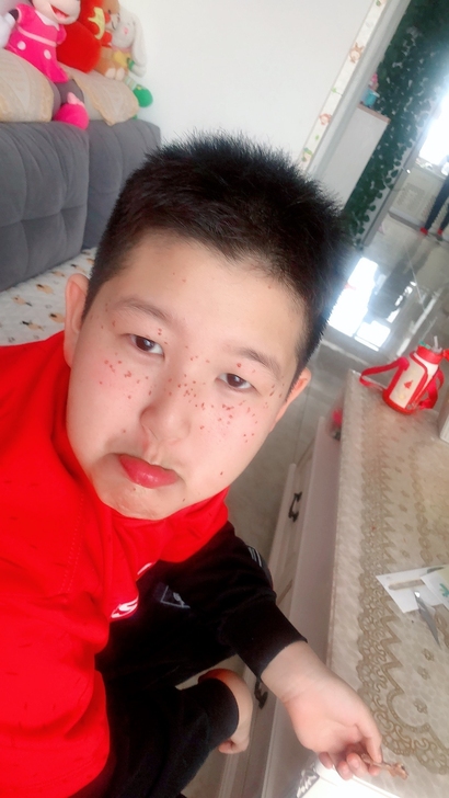 美容仪点痣笔扫斑机洗纹身机器祛斑祛痘印神器...
