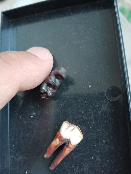 两颗牙齿化石，有喜欢的下单