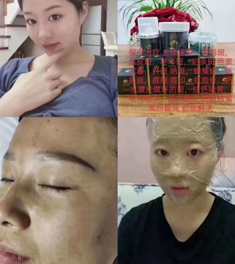不管你是激光激坏的斑，还是药水点坏的斑。我...