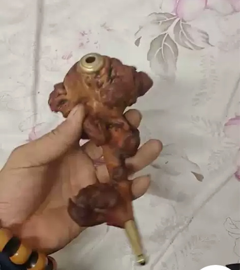 瘤包 烟斗 180 处理； 感兴趣的话点“...