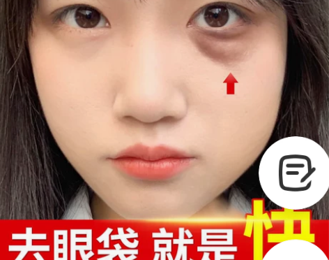 祛眼袋，一抹就消，好不好用，有没有效果！我是自己亲身实践过来...