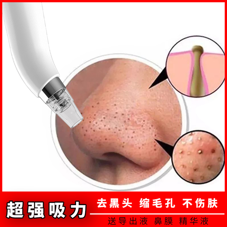 吸黑头神器电动吸收缩毛孔清洁器男女士粉刺洁...