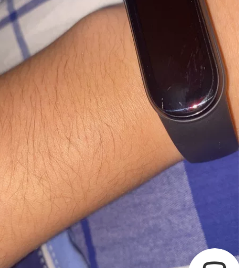 小米手环6nfc 左下角有一点瑕疵 照片对...