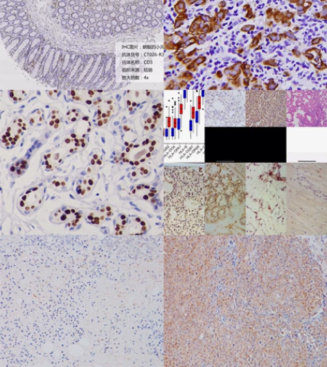 免疫组化/IHC/免疫组织化学染色法/肝肾...