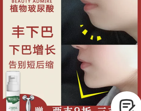 慕心丰下巴凹陷精油增长神器丰脸短后缩平变尖...