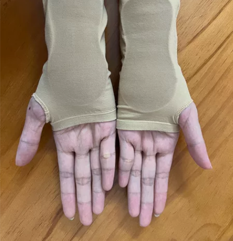 美国bungapads硅胶护掌 手掌部位硅...