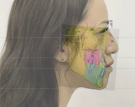 dolphin软件赠送水族馆安装服务2D3...