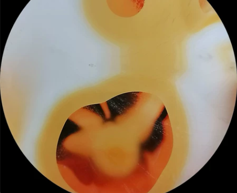 红日当空 感兴趣的话点“我想要”和我私聊吧～